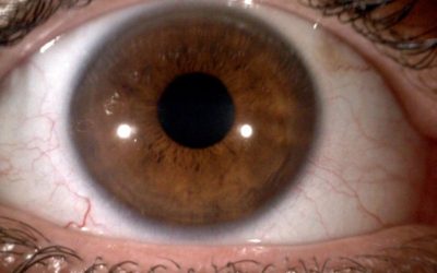 Iridologia, cos’é