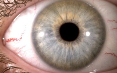 Iridologia, per conoscere te stesso