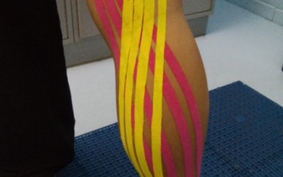 Taping by Silvia