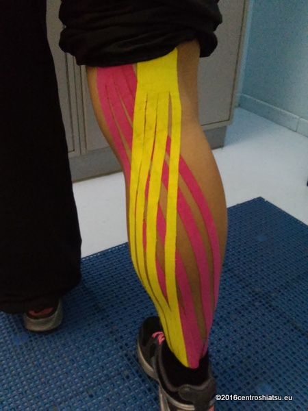 Taping by Silvia